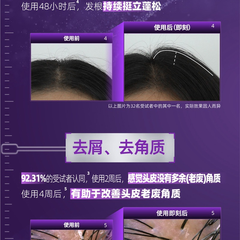 克洛特 头皮益护防脱洗发水套装400mL*3瓶 详情图 6